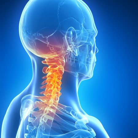Chiropractic care can help with most neck pain