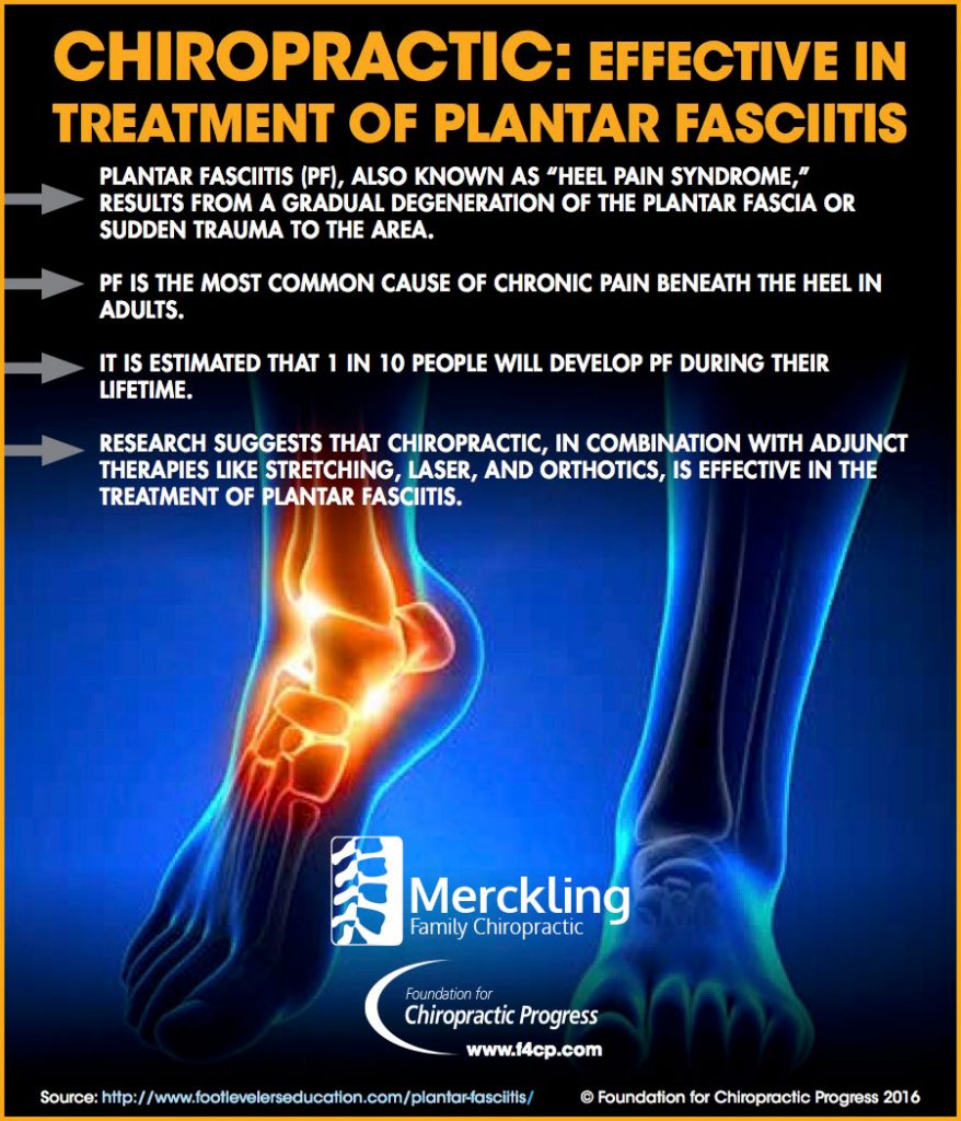 Chiropractic Is an Effective Treatment of Plantar Fasciitis