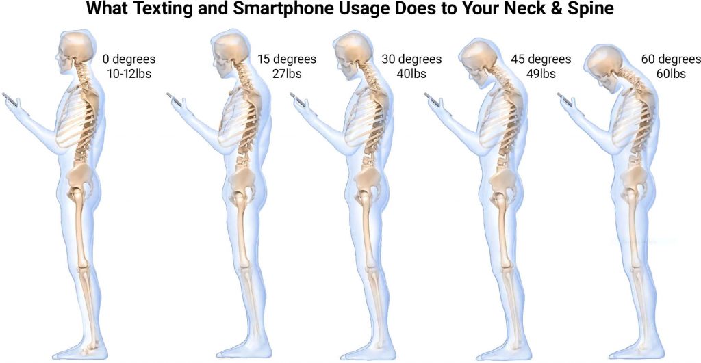 What Texting and Smartphone Usage Does to Your Neck and Spine