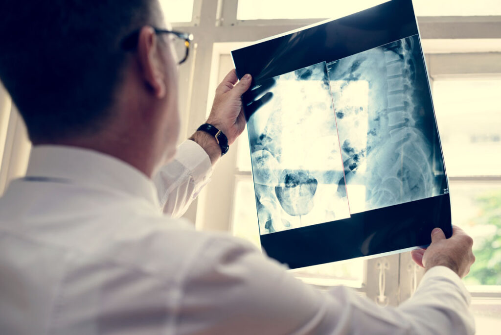 doctor looking at spinal x-ray